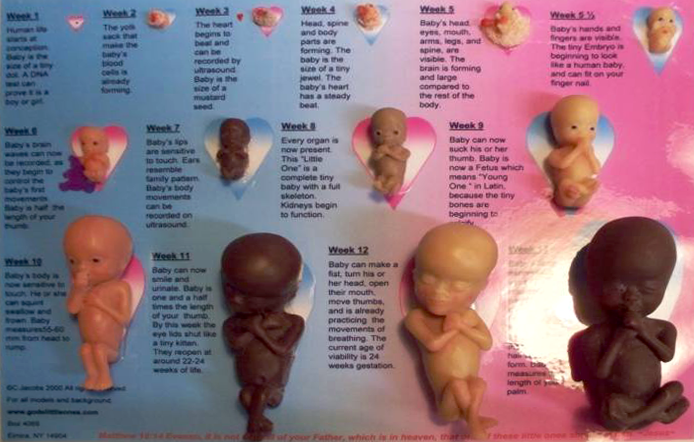Micro Preemies